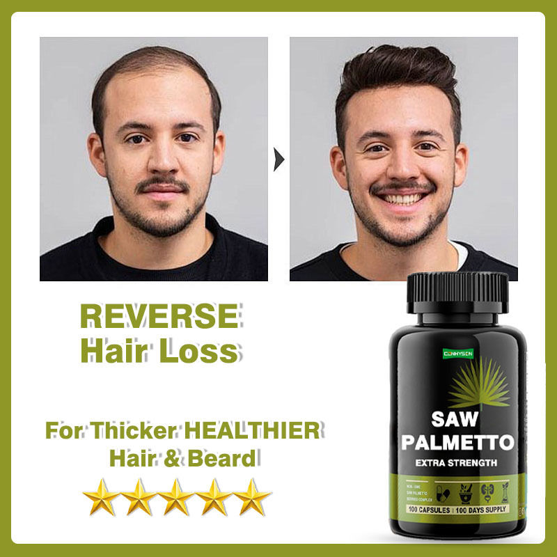 Produttore di integratori Saw Palmetto Capsule Extra Fortezza Per Ridurre la Perdita dei Capelli Supporta la Crescita